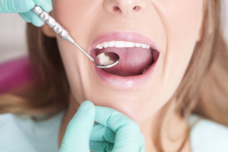 tennene dine, forhindre hulrom, mellom tennene, besøke tannlegen, bidra forhindre