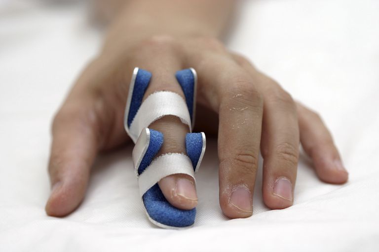 skadede fingeren, være nødvendig, behandlingen Undersøkelse, eller ustabil, fleste fingerfrakturer, gjør knyttneve