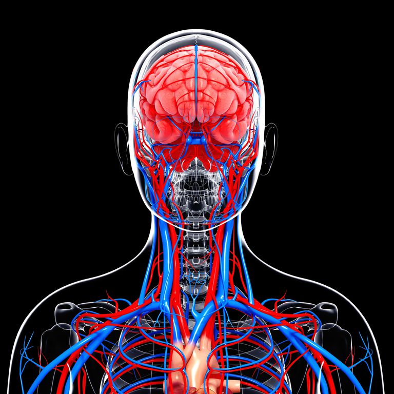karoten arterier, Artery Stenosis, blitt fortalt, Carotid Artery, Carotid Artery Stenosis