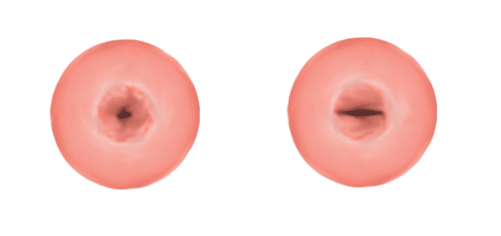 Cervical Os er to deler av livmorhalsen