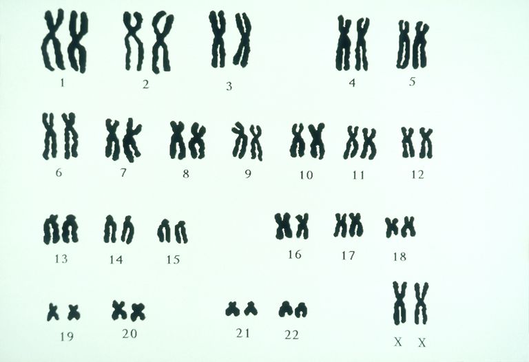 FISH-analyse karyotype, alle kromosomene, Downs syndrom, Fordi karyotype, Fordi karyotype informasjon, hvert kromosom