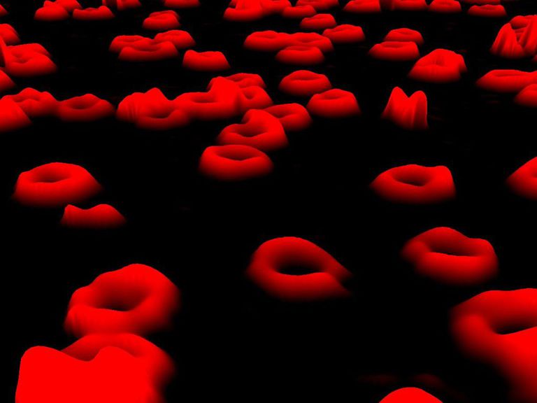 røde blodlegemer, lavt hemoglobinnivå, anemi eller, antall røde, antall røde blodlegemer