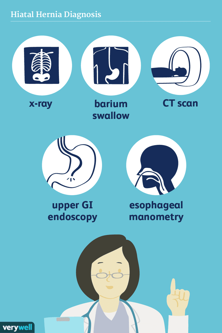 hiatal brokk, spiserøret magen, gjennom neseboret, glir hiatusen, hjelpe legen, klassifisert etter