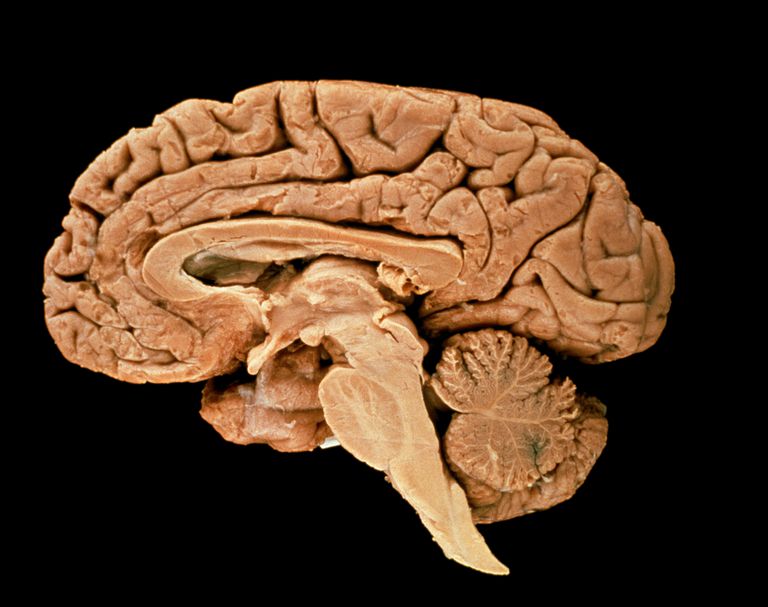 hjernestammen ansvarlig, Hvordan påvirker, Hvordan påvirker hjernestammen, lidelse hvor