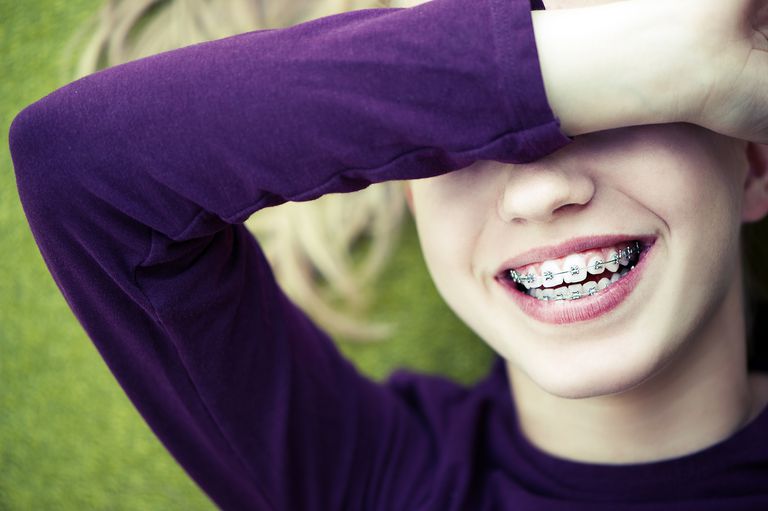 barnet ditt, barnets tenner, ikke eneste, ortodontisk behandling