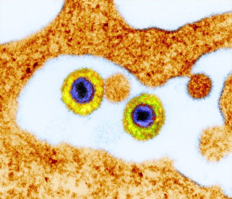 dette viruset, mest sannsynlig, aktiv infeksjon, behandling HHV-6