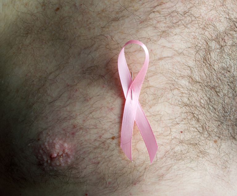 mannlig brystkreft, Klinefelter syndrom, American Cancer, American Cancer Society, Cancer Society, Dette skyldes