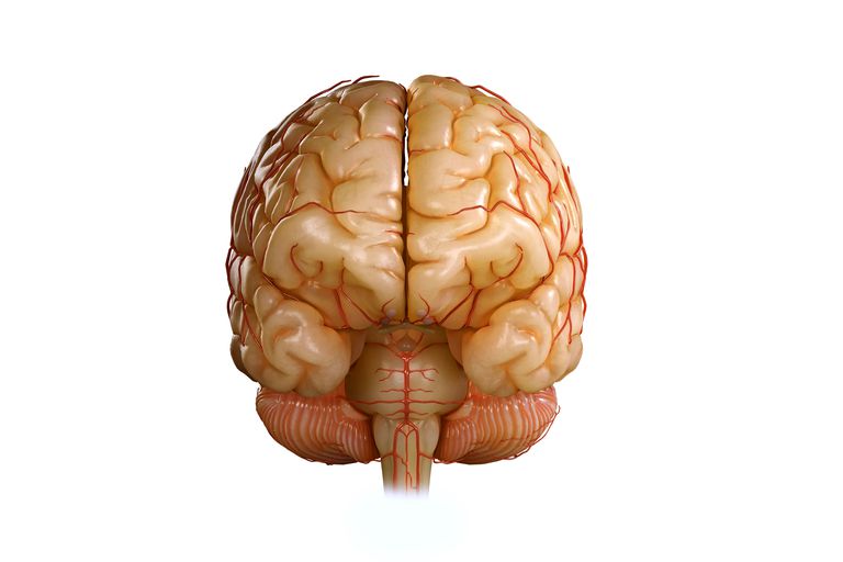 hjernen utenfor, hjernen utenfor sentrum, Midline Shift, skyver hjernen, tredje ventrikelen