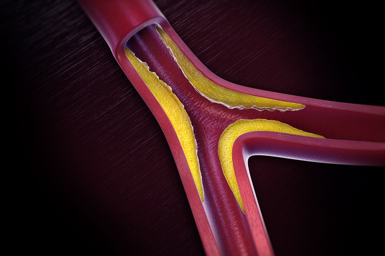 arteriene leverer, berørte lemmen, berørte lemmet, eller flere