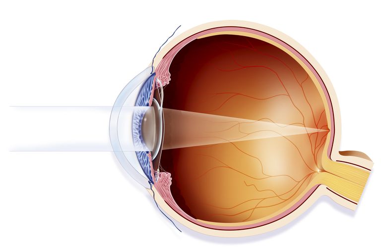 PAM-test ikke, annen øyesykdom, forbedre synet, intraokulært linseimplantat, Studier viser