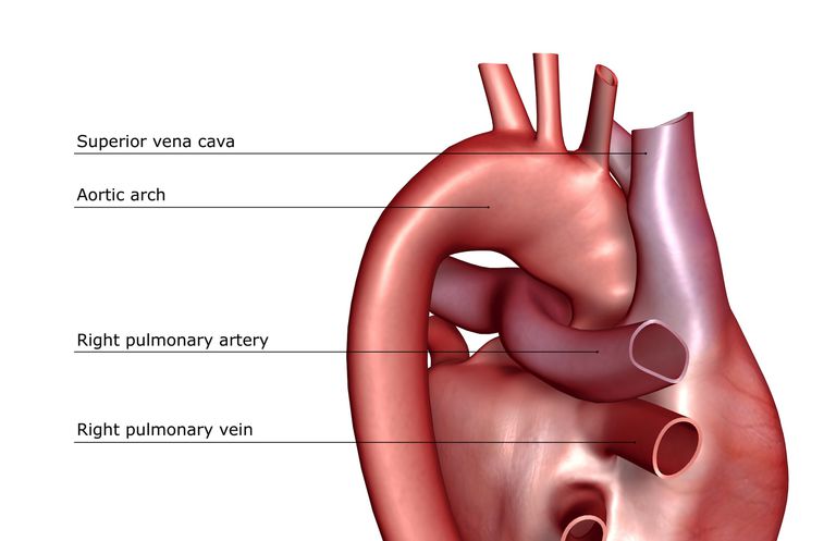 blod lungene, hjertet vårt, arteriell hypertensjon, arteriene rundt, arteriene rundt lungene, begge sider