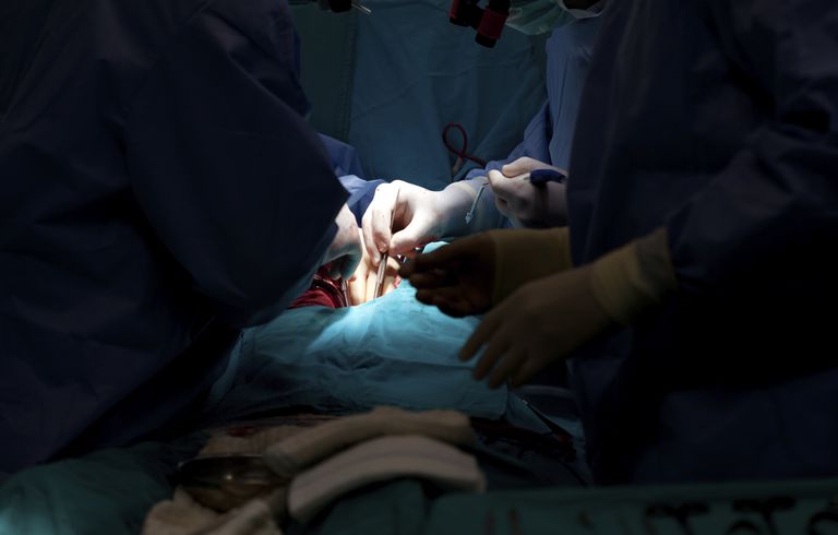 bypass kirurgi, etter operasjonen, arterie bypass, arterie bypass kirurgi, artery bypass, coronary artery