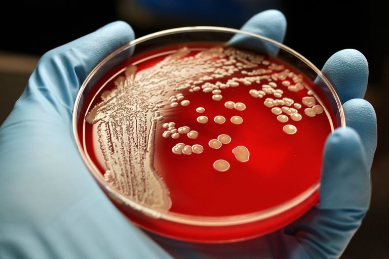 cystisk fibrose, Staphylococcus aureus, annen person, eller andre, fleste MRSA-infeksjoner, forurenset MRSA
