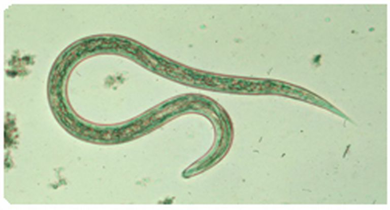 Celiac sykdom, hookworm larver, behandle cøliaki, Cook University, hookworms viser, James Cook
