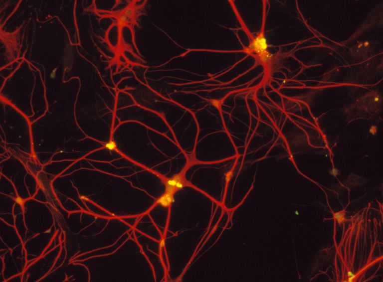 Ependymale celler, antas være, autonome nervesystemet, blant annet