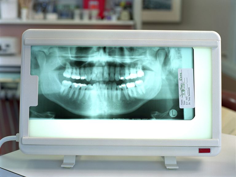 ortodontisk behandling, Ortodontiske poster, ortodontiske tannregistre, denne røntgen