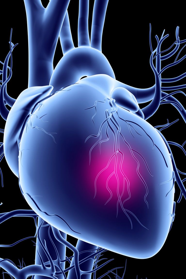 Framingham Heart, Framingham Heart Study, Framingham Risk, Heart Study, National Heart