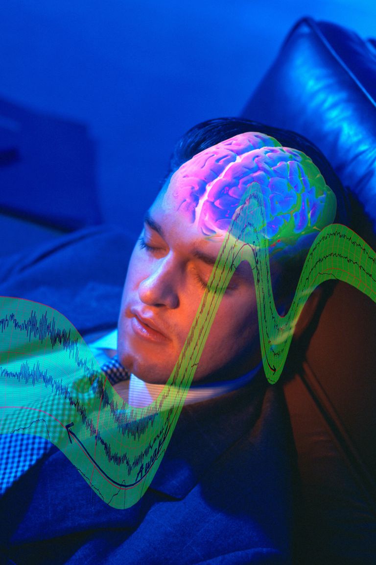 øyebevegelses søvn, NREM søvn, bevegelses søvn, brukes vurdere, elektriske mønstrene, ikke rask