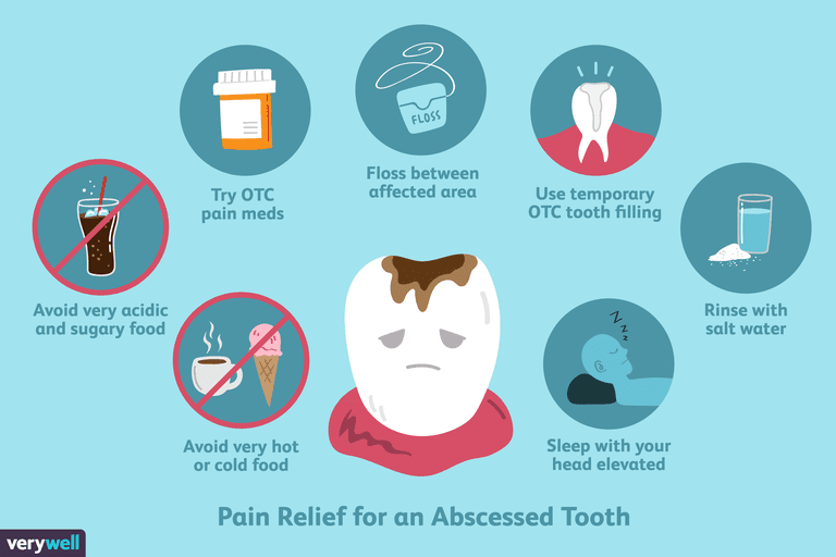 abscessert tann, tann abscess, tann eller, tannpine forårsaket, absolutt tann