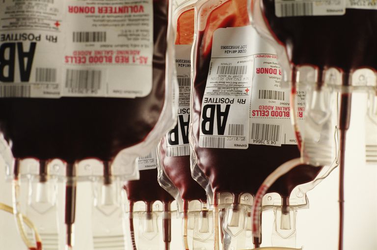 blod Blod, donert blod, enhet blod, ikke-hemolytisk transfusjonsreaksjon